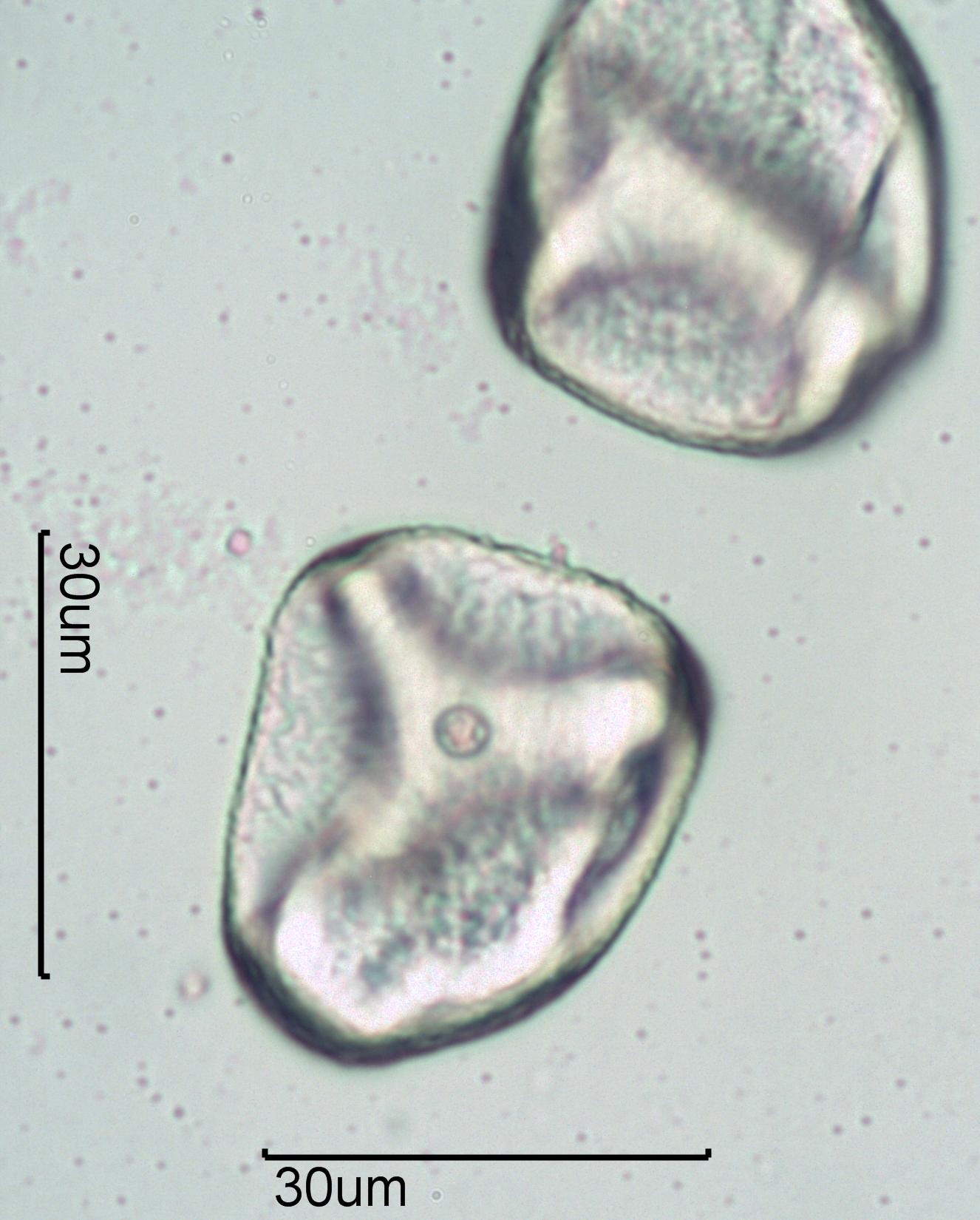 Grass Family Poaceae Pollen Under The Microscope grass-family-poaceae-pollen-under-the-microscope